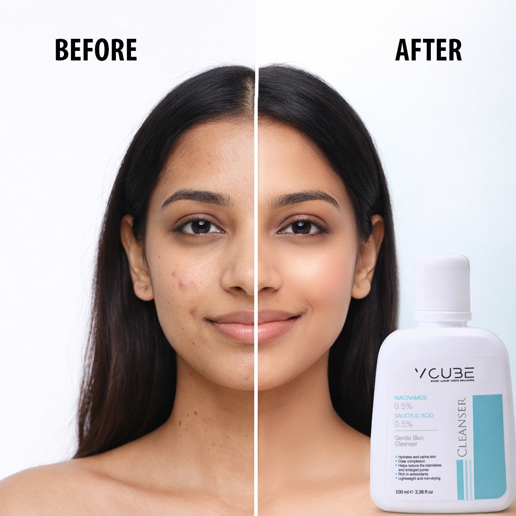 Gentle Skin Cleanser with Niacinamide 0.5% & Salicylic Acid 0.5% | VCube Cleanser