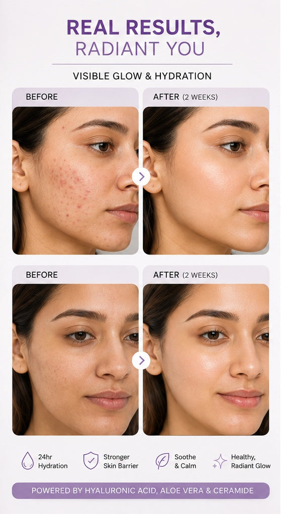 Hydra Glow Moisturizer  2% Hyaluronic Acid + 2% Ceramide