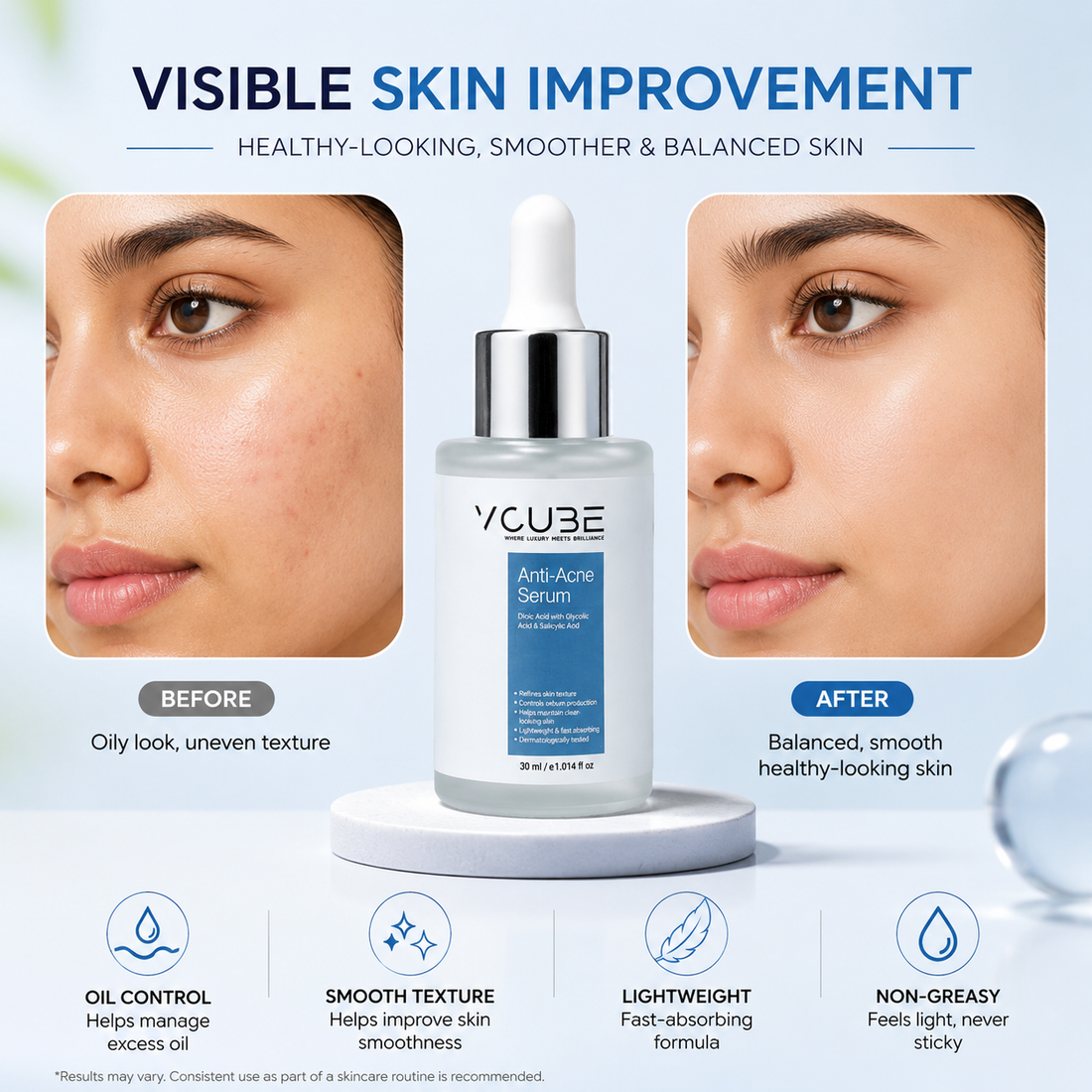 Anti Acne Face Serum with Salicylic Acid 1% & Glycolic Acid 2% for Pimples, Blackheads & Oil Control | Fragrance Free Vegan Serum – VCube